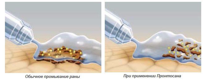 Пронтосан.jpg